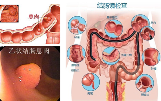 萎縮性胃炎真的“很嚇人”？看完這“七個(gè)事實(shí)”你就明白了